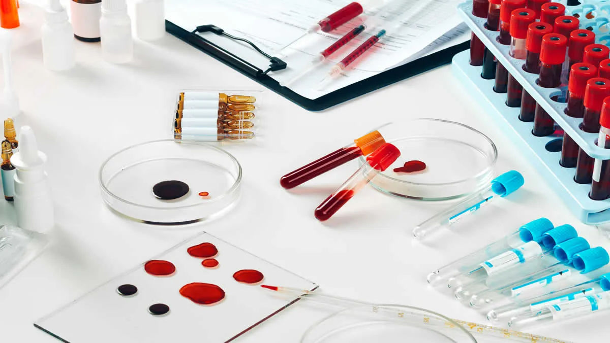 How to Store EDTA Blood Samples: Temperature and Duration
