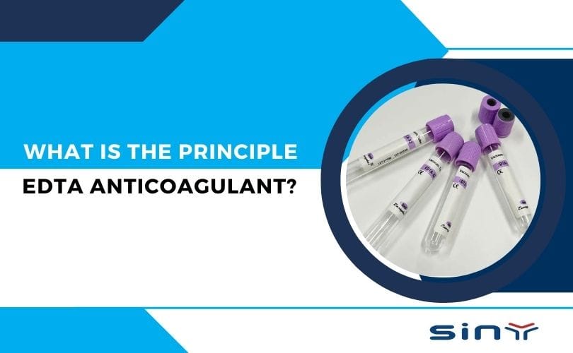 What is the Principle of EDTA Anticoagulant