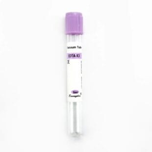 5ml K2 EDTA Vacuum Blood Collection Tube