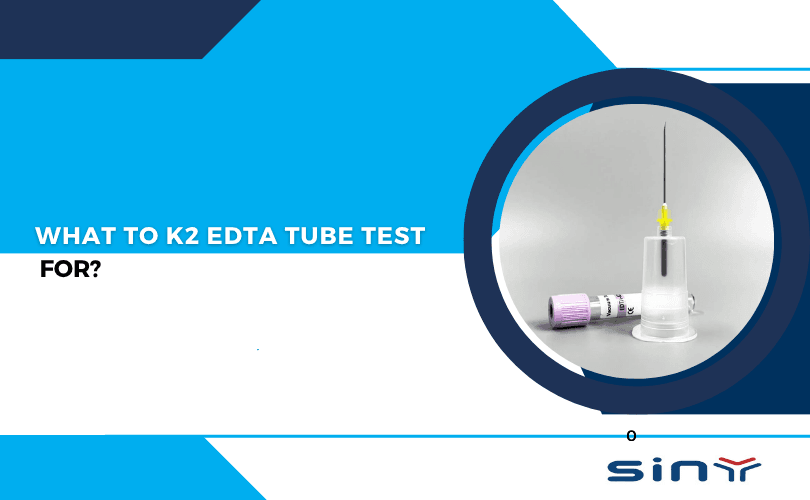 What to K2 EDTA tube test for